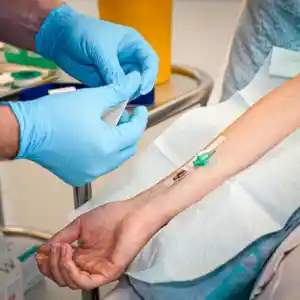 Eine Hand im linken Bildrand legt eine Kanüle im Arm einer Person in rechten Bildrand